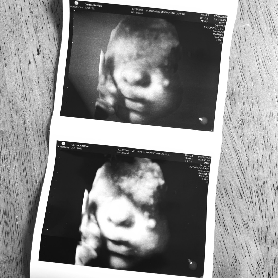 Photo shared by Kaitlyn for their Babylist baby registry.