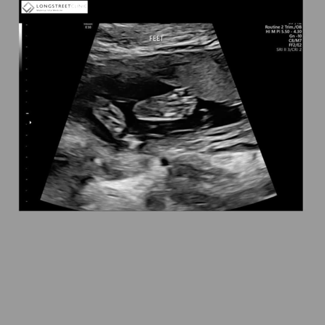 Photo shared by Heidy for their Babylist baby registry.