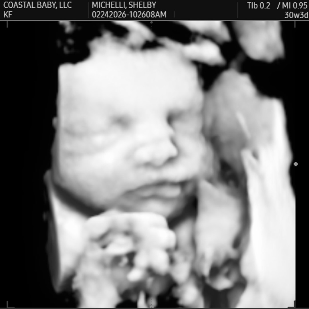 Photo shared by Shelby for their Babylist baby registry.