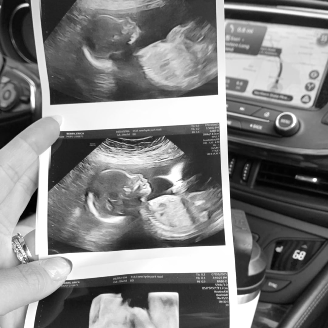 Photo shared by Erica for their Babylist baby registry.