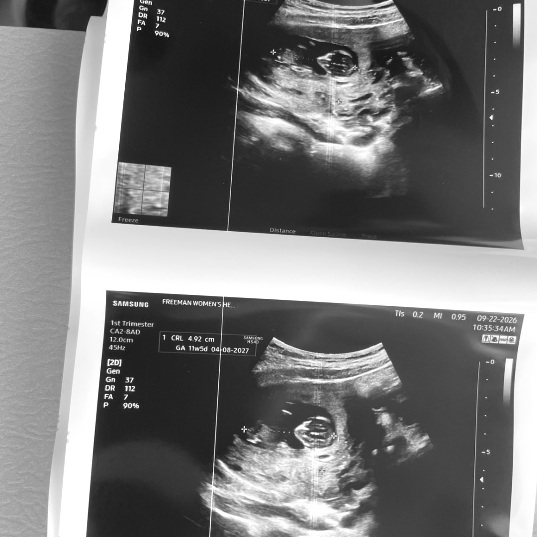 Photo shared by Hayli for their Babylist baby registry.