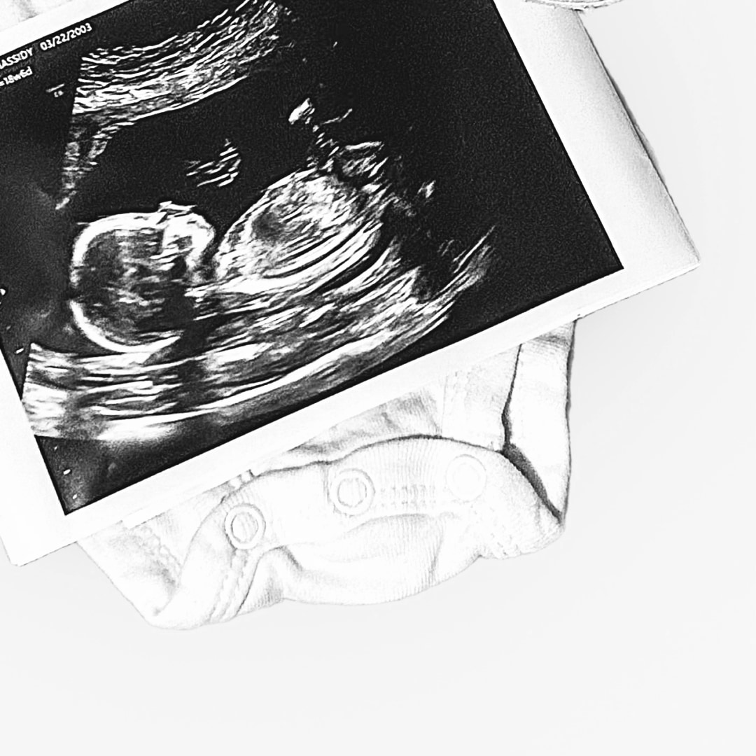 Photo shared by Chassidy for their Babylist baby registry.