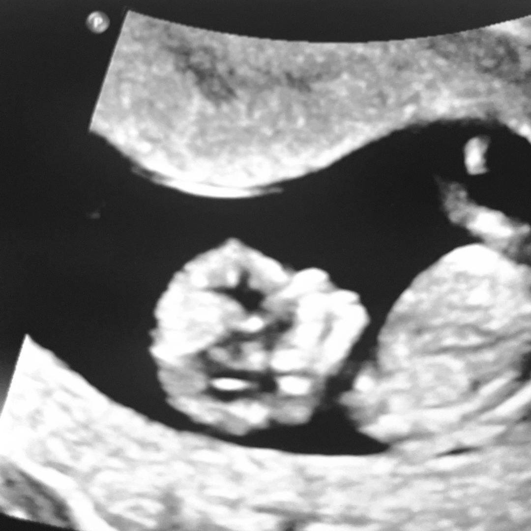 Photo shared by Danielle for their Babylist baby registry.
