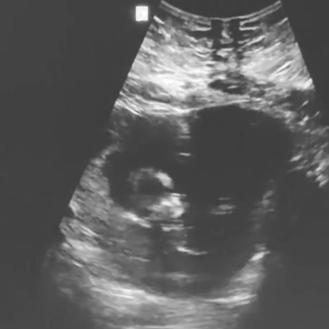 Photo shared by Jennifer for their Babylist baby registry.