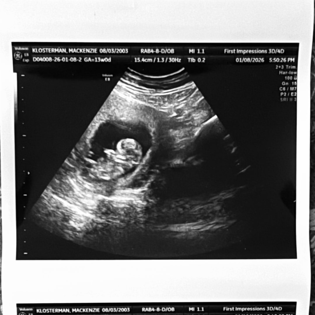 Photo shared by Mackenzie for their Babylist baby registry.