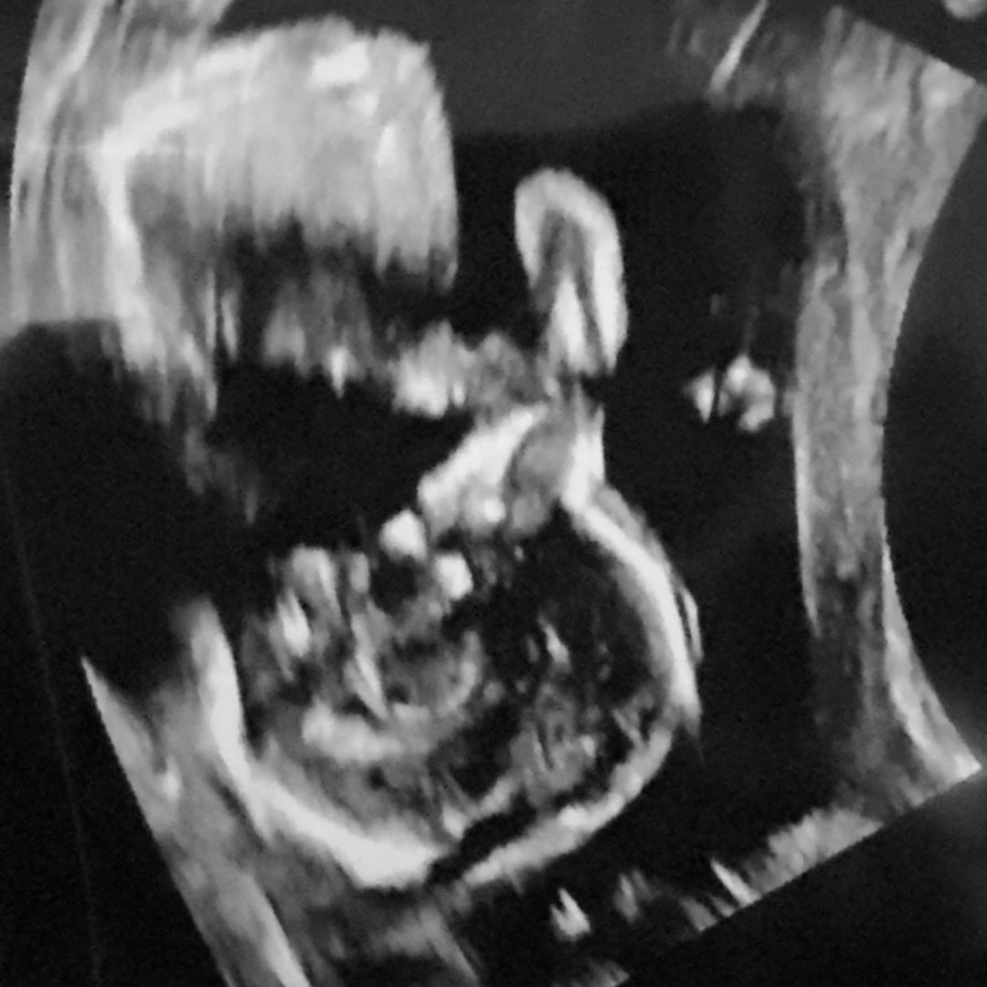 Photo shared by Alexis for their Babylist baby registry.