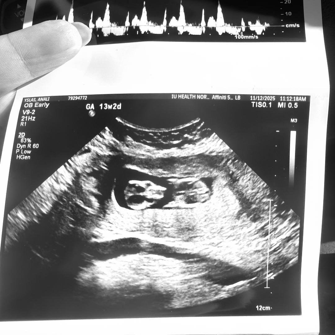 Photo shared by Anali for their Babylist baby registry.