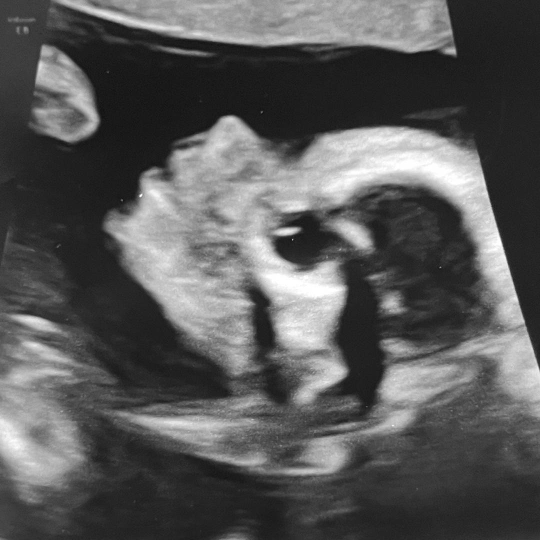 Photo shared by Amalia for their Babylist baby registry.