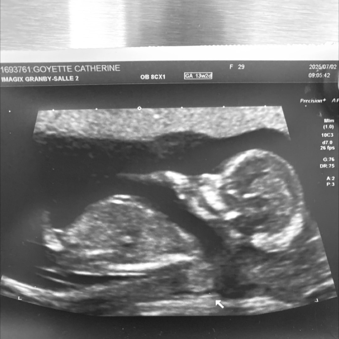 Photo shared by Catherine for their Babylist baby registry.