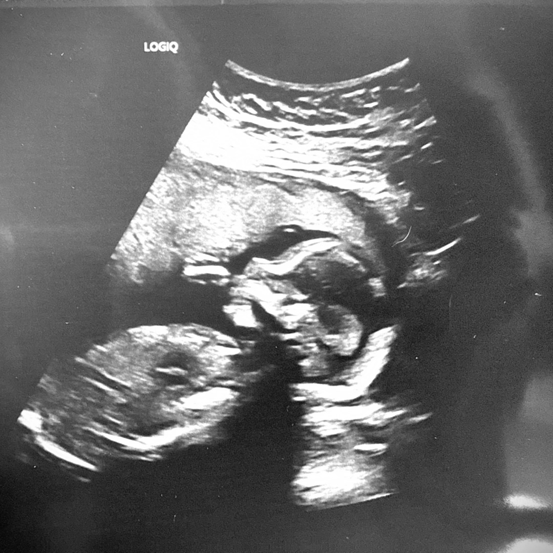 Photo shared by Savannah for their Babylist baby registry.