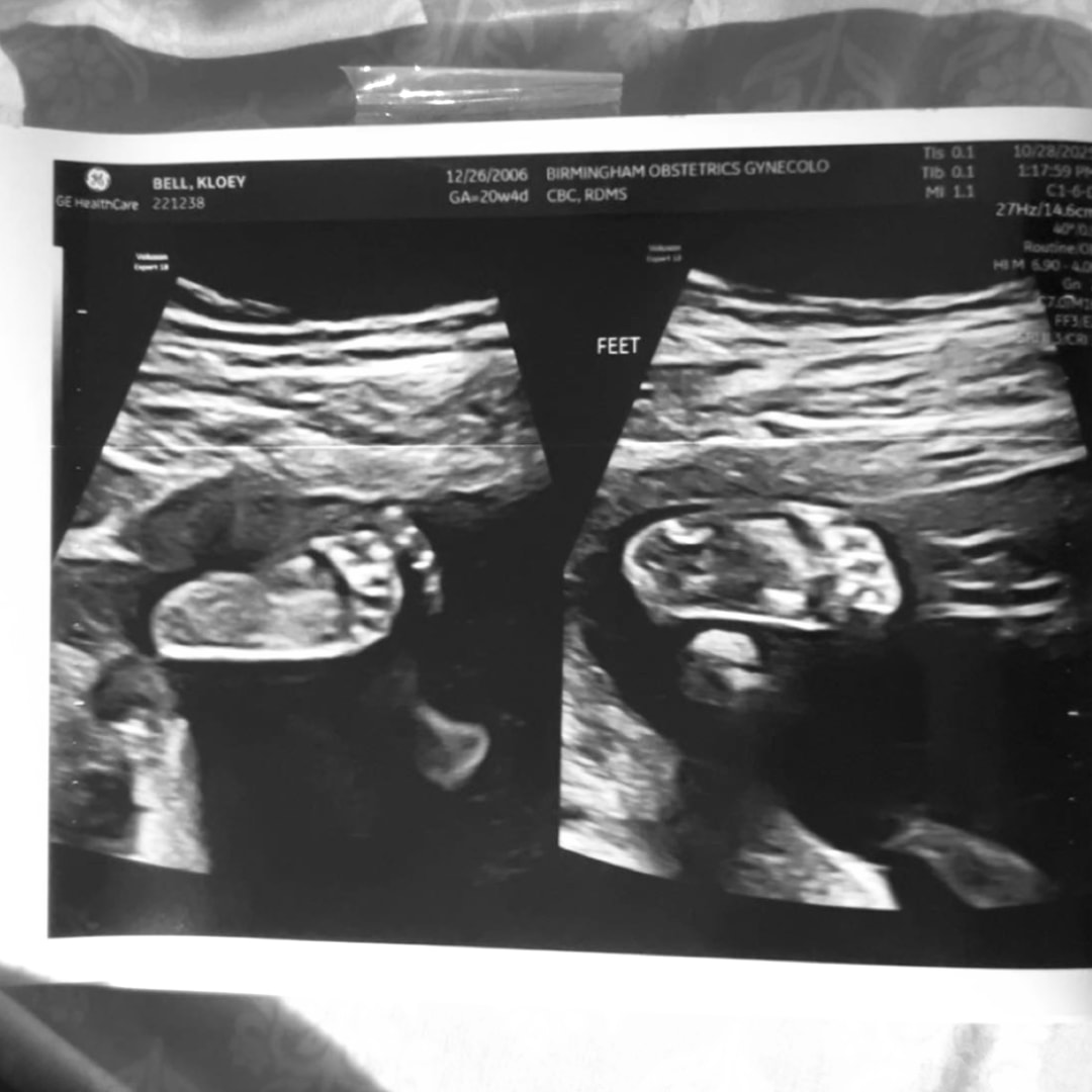 Photo shared by Kloey for their Babylist baby registry.