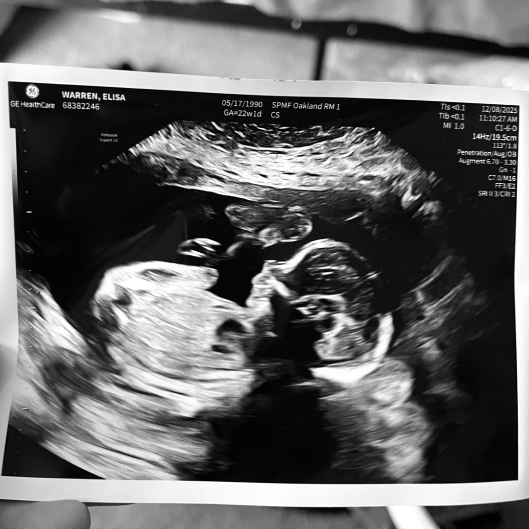 Photo shared by Elisa for their Babylist baby registry.