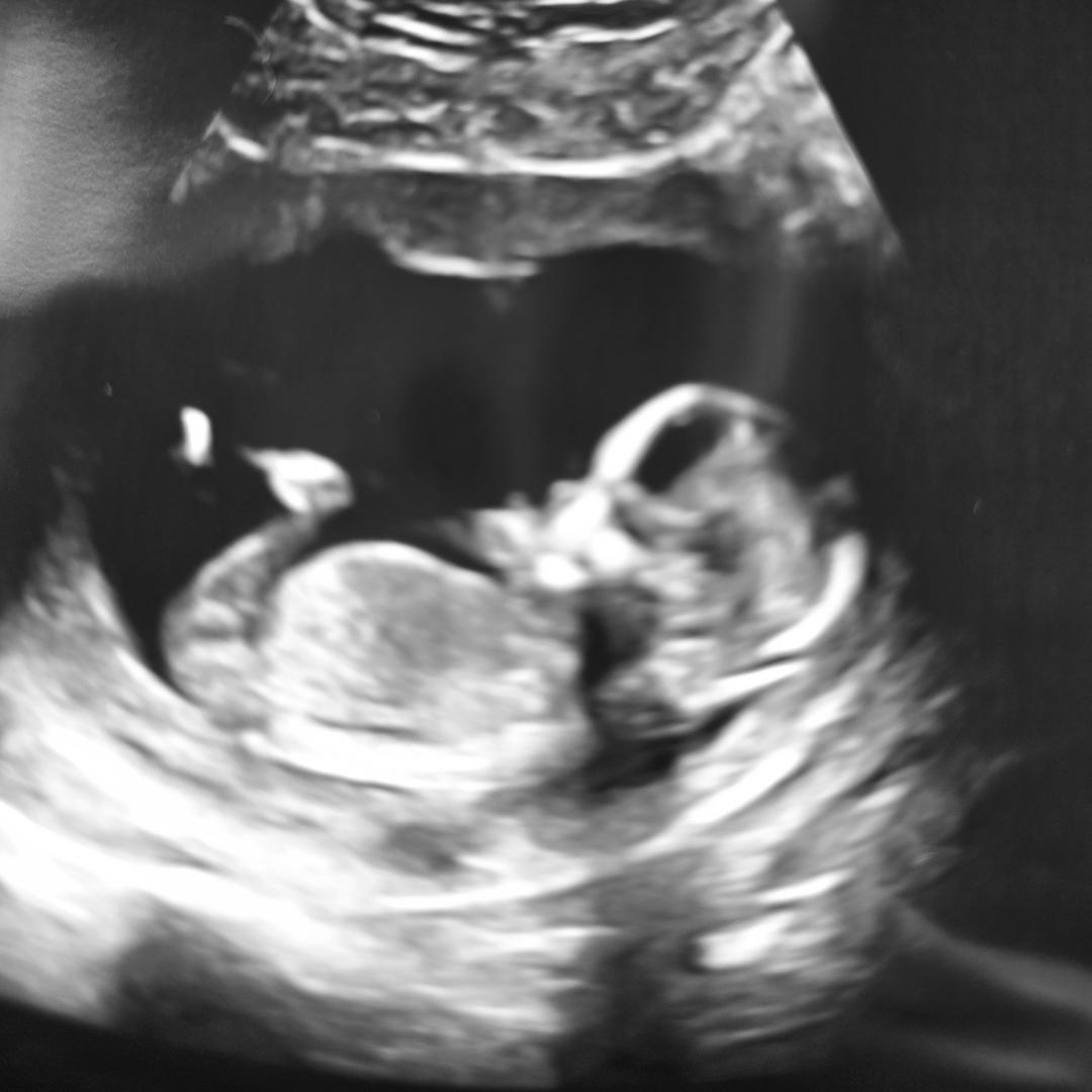Photo shared by Arielle for their Babylist baby registry.