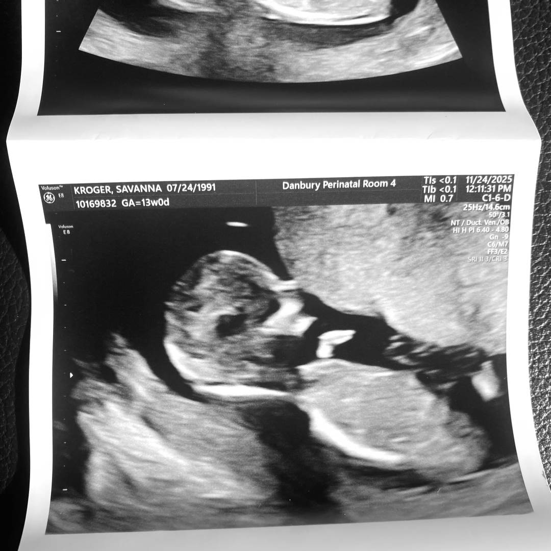 Photo shared by Savanna for their Babylist baby registry.