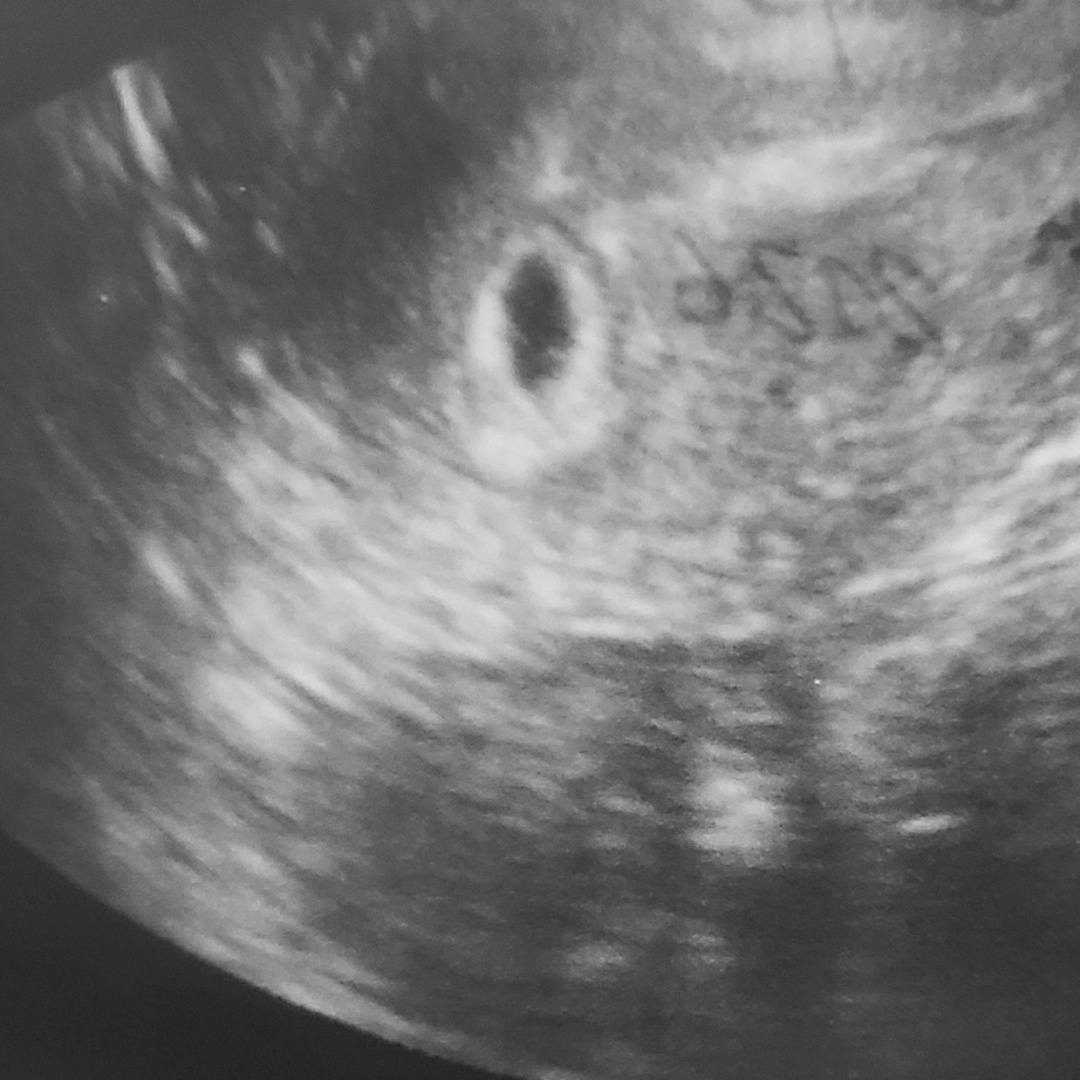 Photo shared by Danielle for their Babylist baby registry.