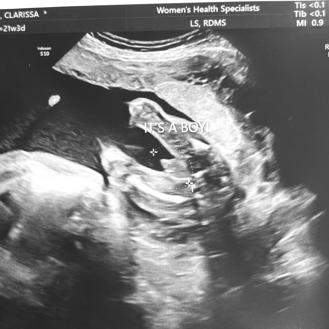 Photo shared by Clarissa for their Babylist baby registry.