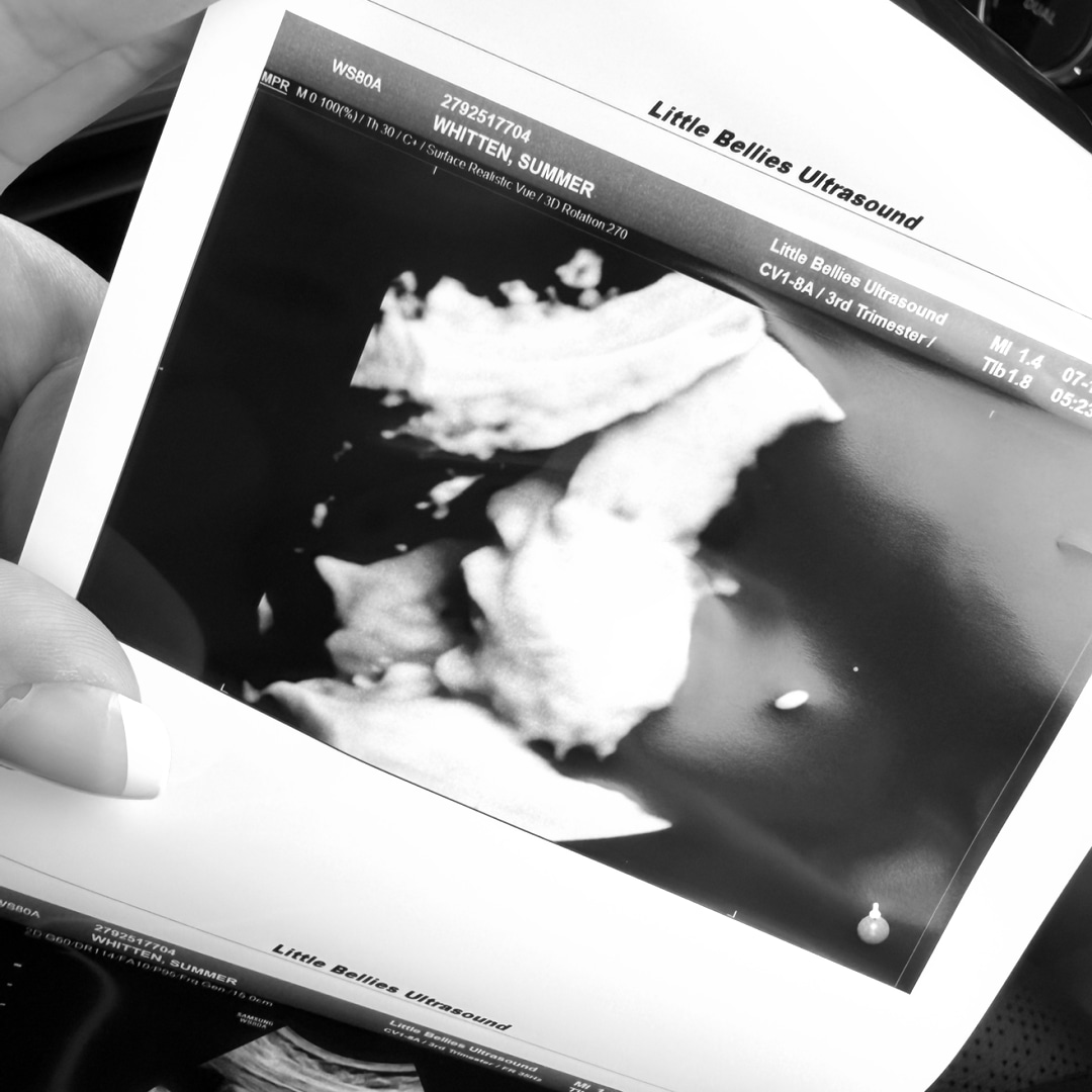 Photo shared by Summer for their Babylist baby registry.