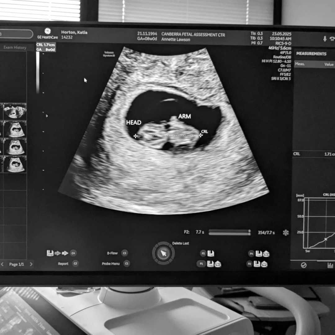 Photo shared by Katia for their Babylist baby registry.