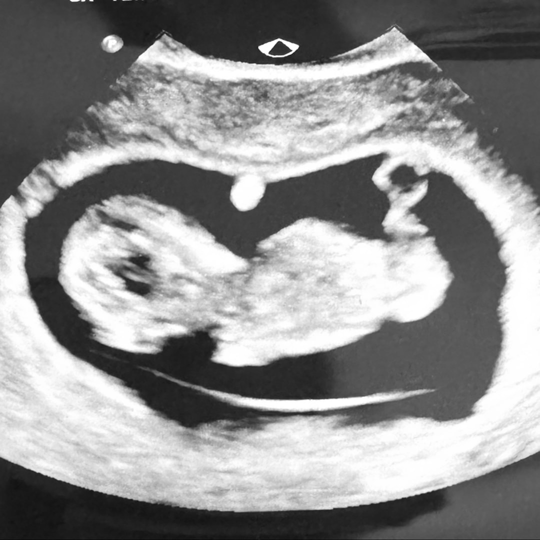 Photo shared by Abigail for their Babylist baby registry.