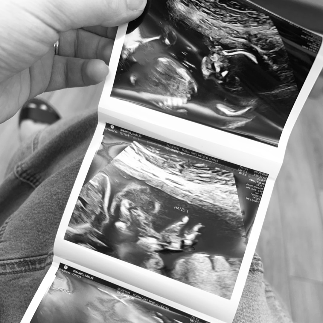 Photo shared by Harley for their Babylist baby registry.