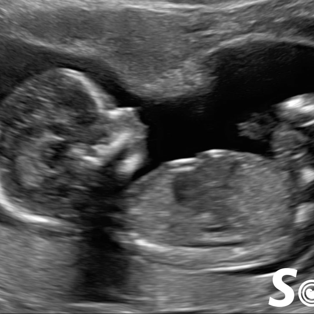 Photo shared by Jess for their Babylist baby registry.