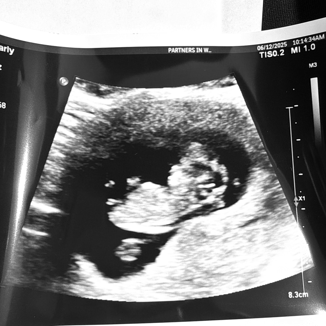 Photo shared by Morgan for their Babylist baby registry.