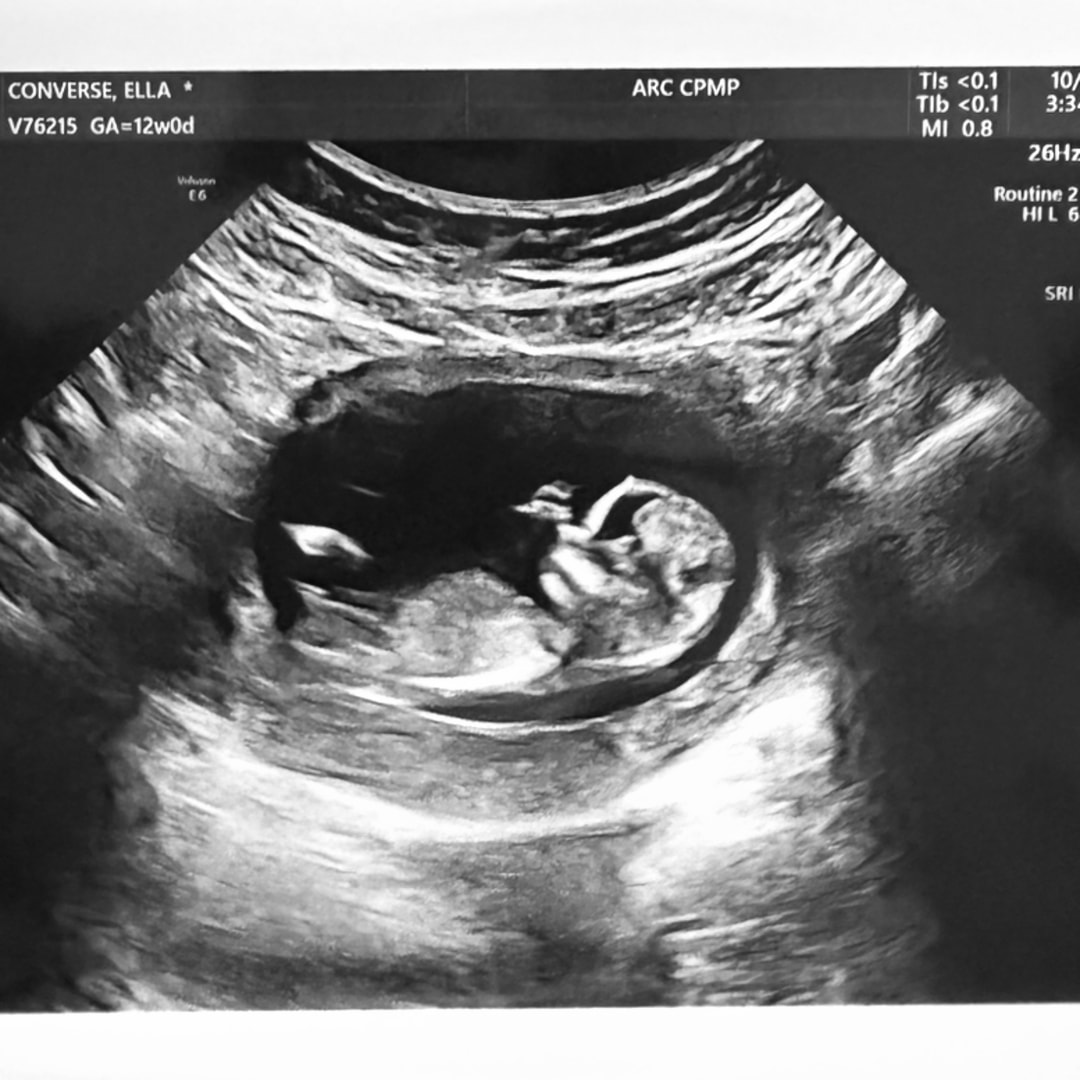 Photo shared by Ella for their Babylist baby registry.