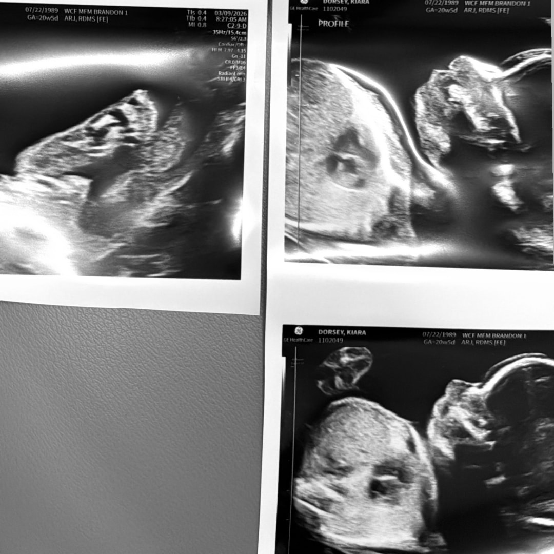 Photo shared by Kiara for their Babylist baby registry.