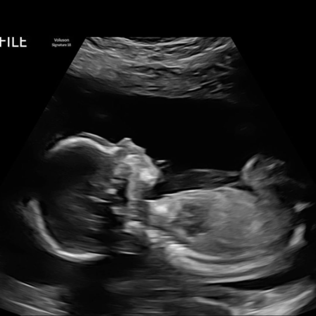 Photo shared by Trinitie for their Babylist baby registry.