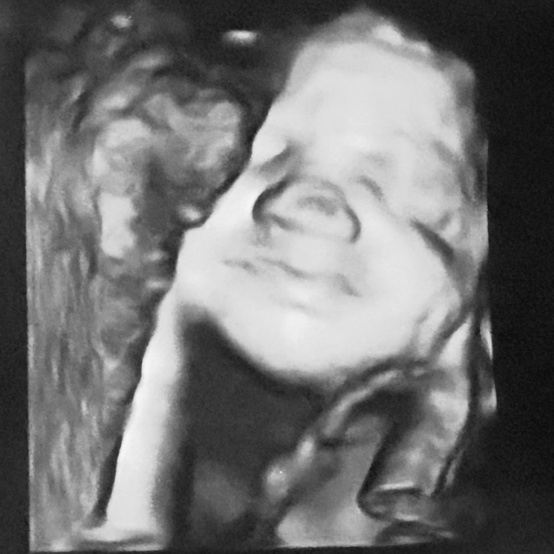 Photo shared by Abby for their Babylist baby registry.