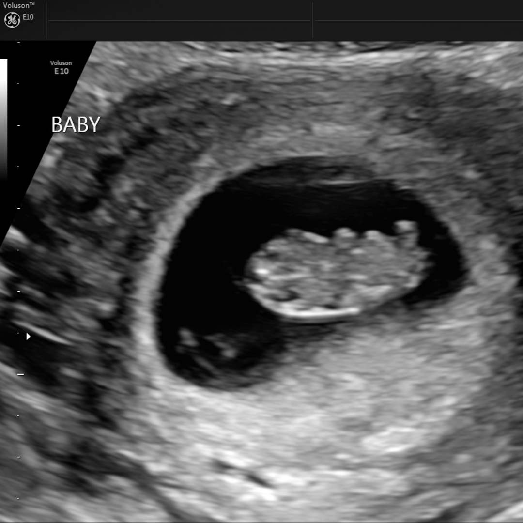 Photo shared by Lily for their Babylist baby registry.