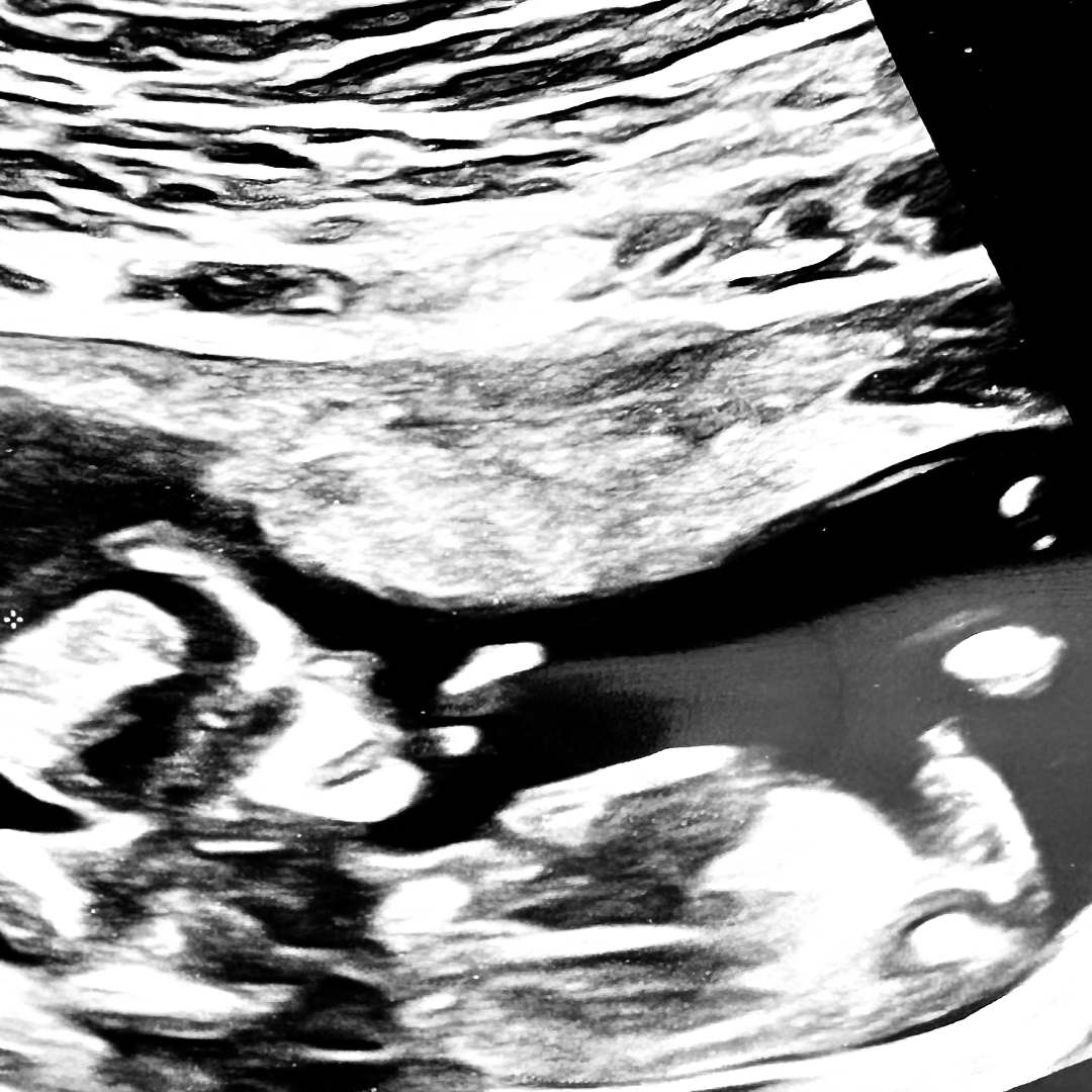 Photo shared by Dalymar for their Babylist baby registry.