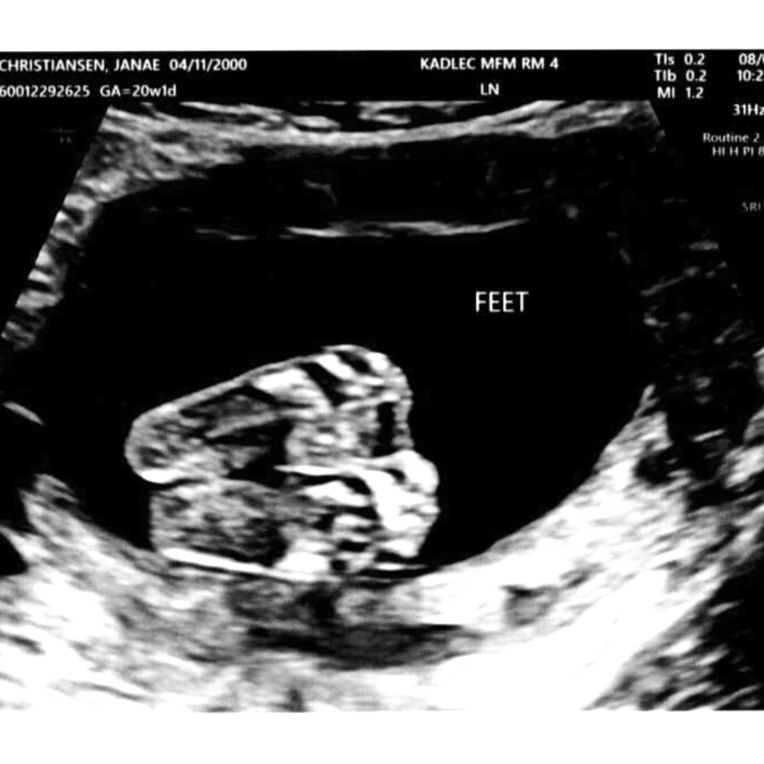 Photo shared by Janae for their Babylist baby registry.