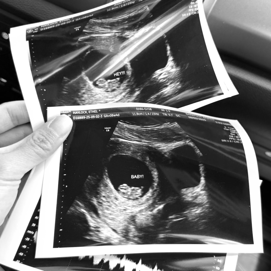 Photo shared by Ethel for their Babylist baby registry.