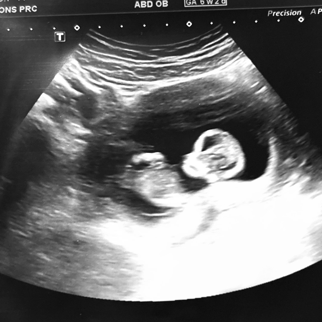 Photo shared by Kaysea for their Babylist baby registry.