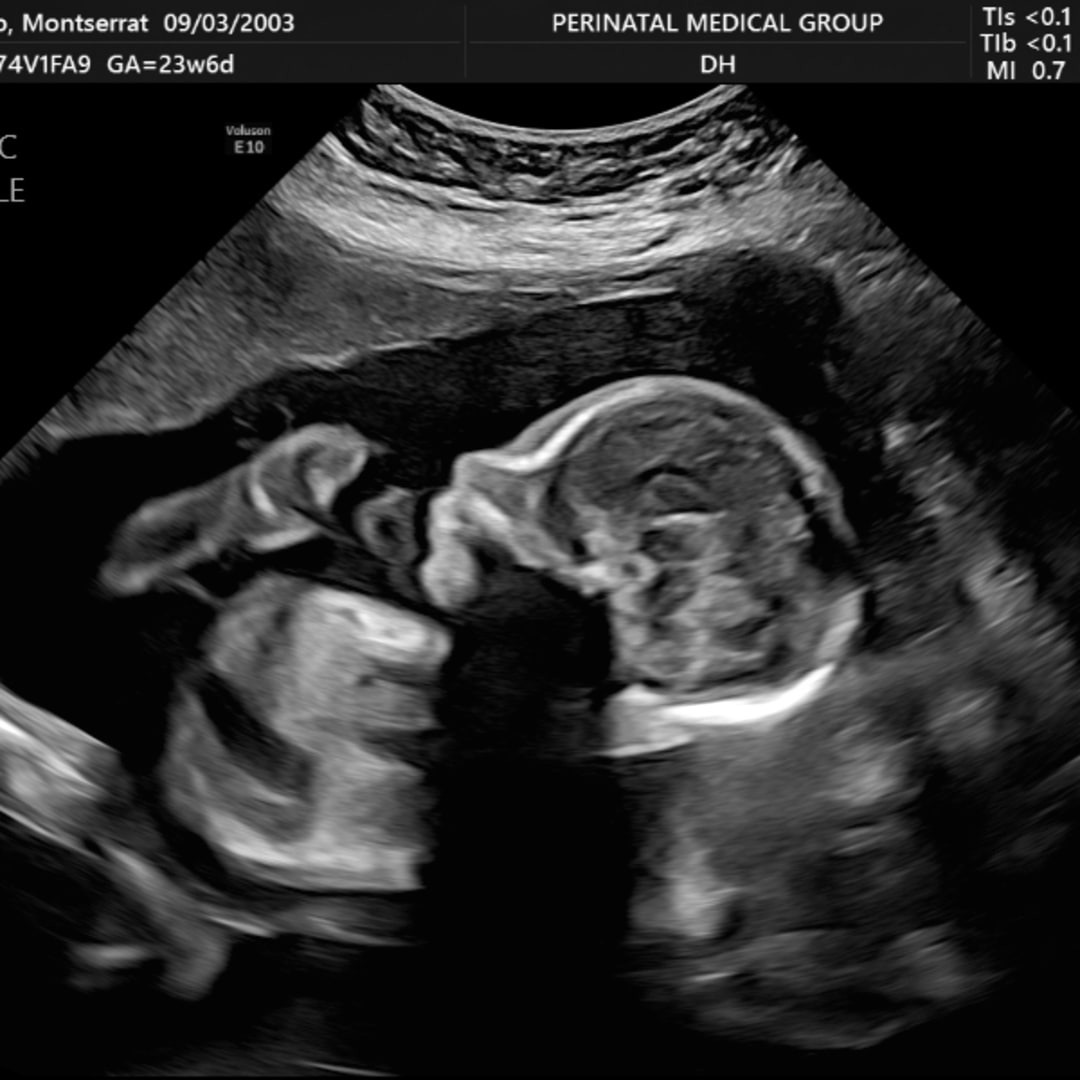 Photo shared by Montserrat for their Babylist baby registry.