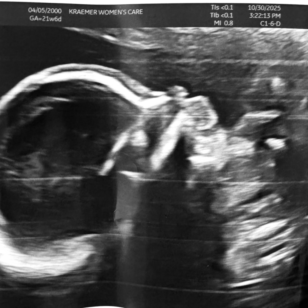 Photo shared by Kylie for their Babylist baby registry.