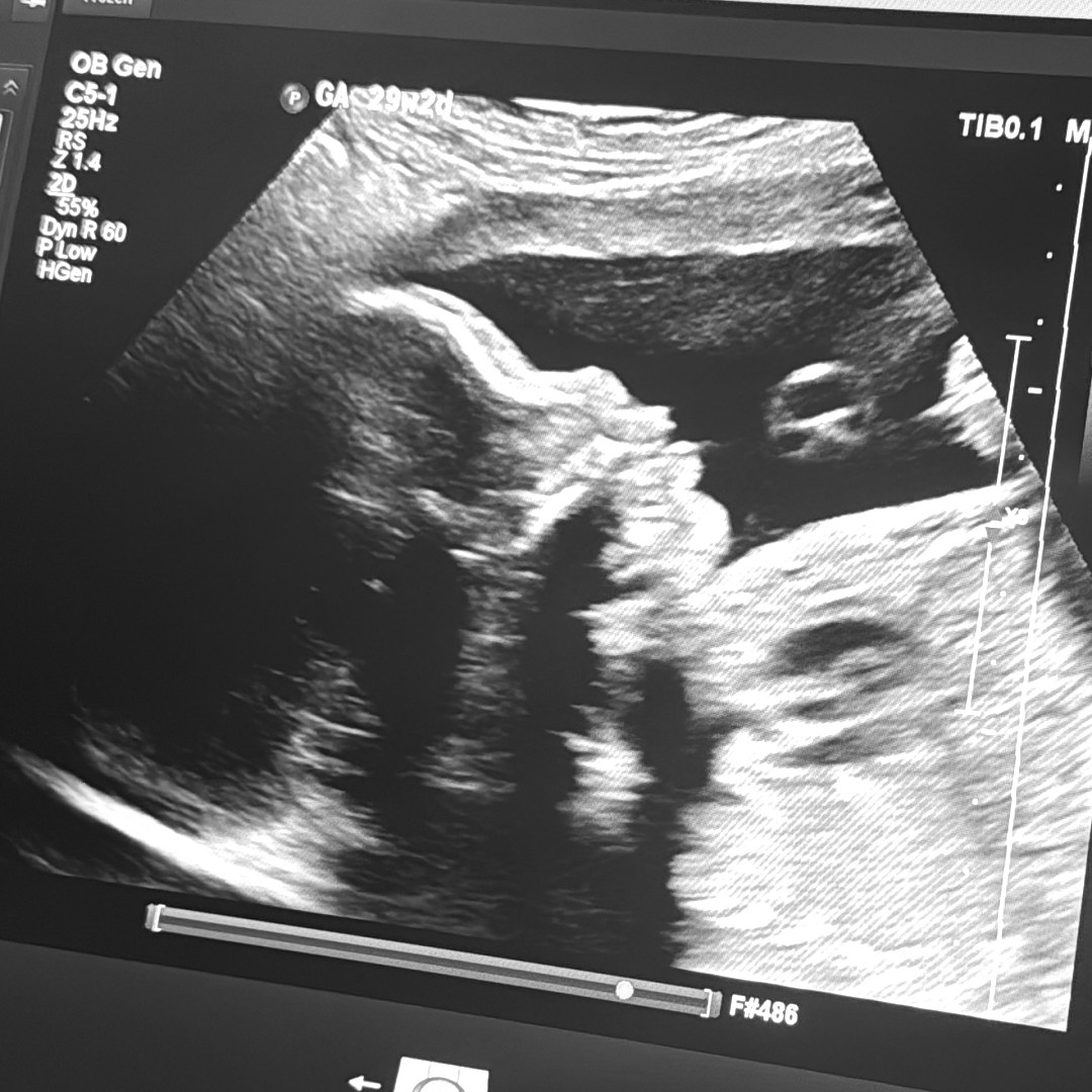 Photo shared by Jeanine for their Babylist baby registry.