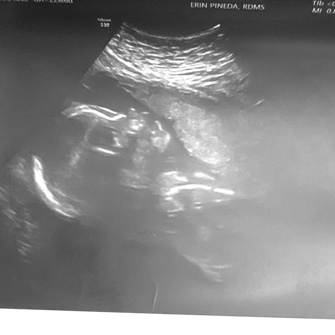 Photo shared by Alize’ for their Babylist baby registry.