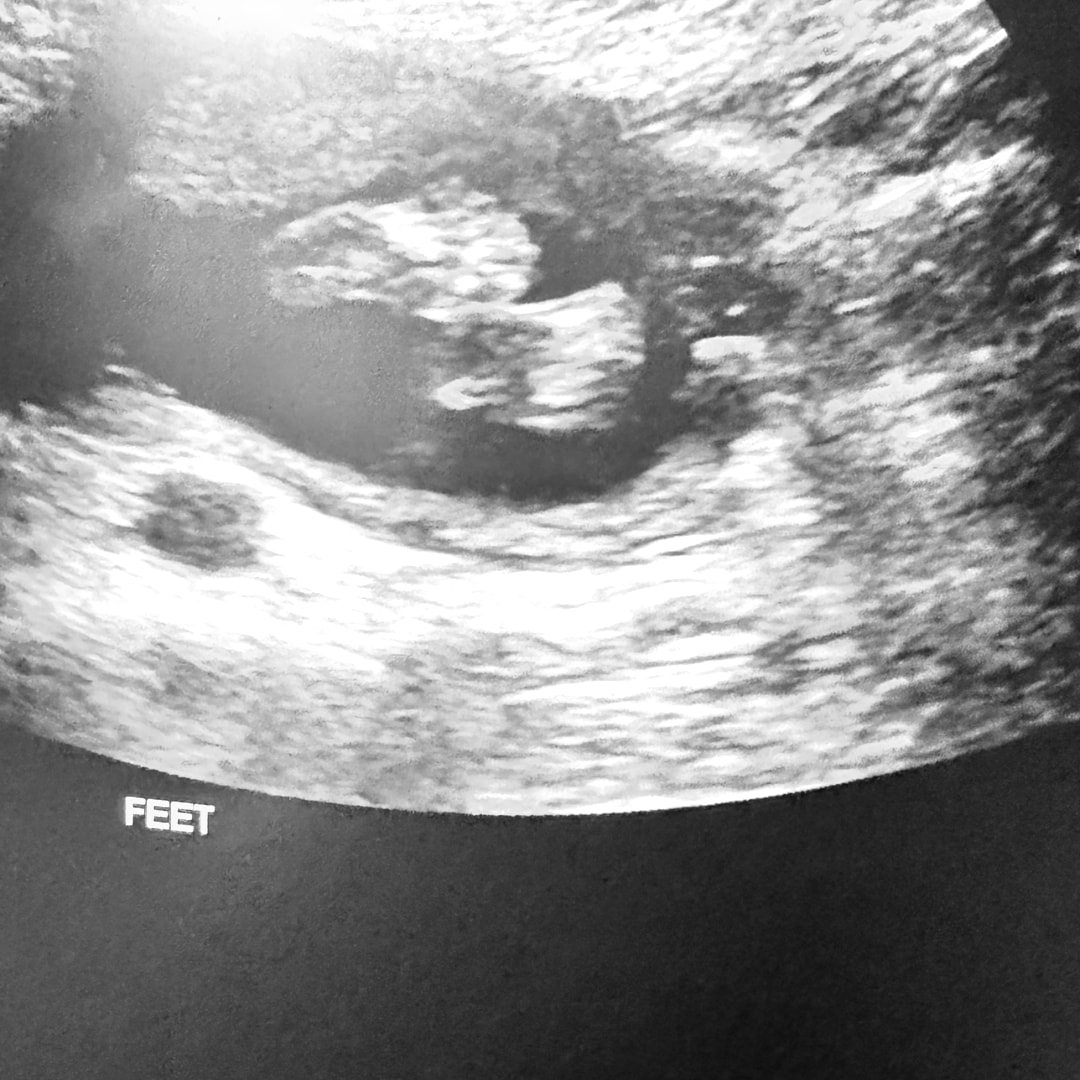 Photo shared by Jaydn for their Babylist baby registry.
