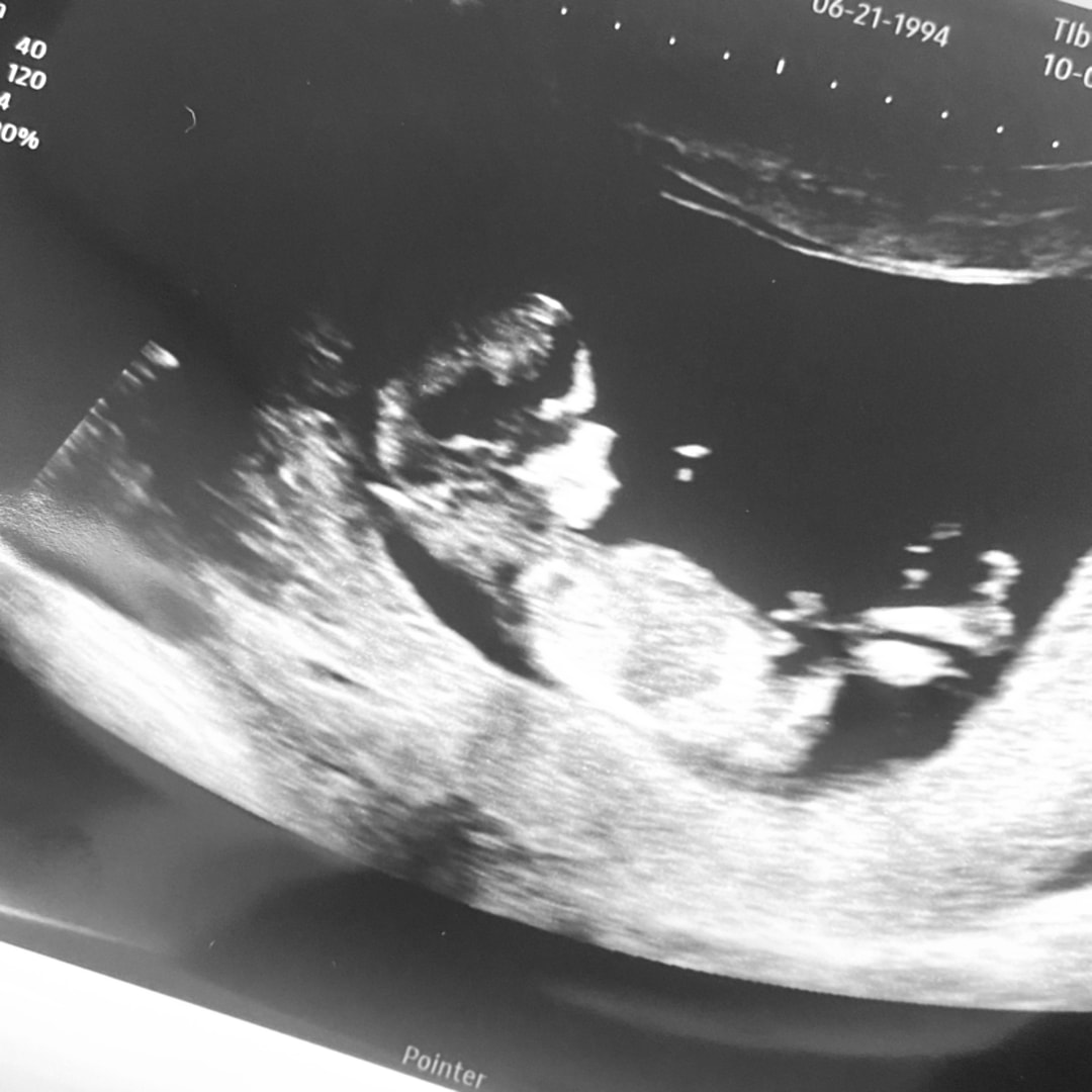 Photo shared by Taylor for their Babylist baby registry.