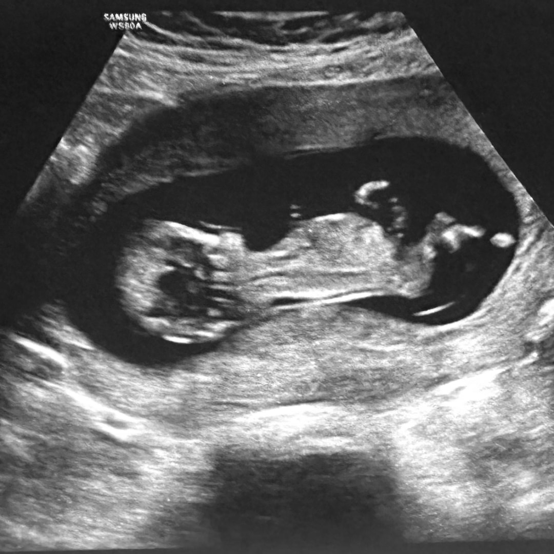 Photo shared by Karlee for their Babylist baby registry.