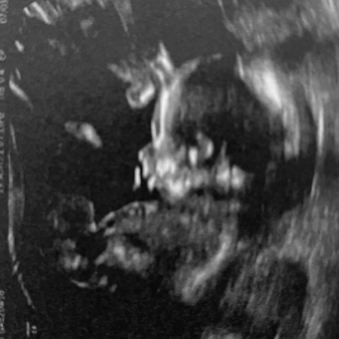 Photo shared by Brianna for their Babylist baby registry.