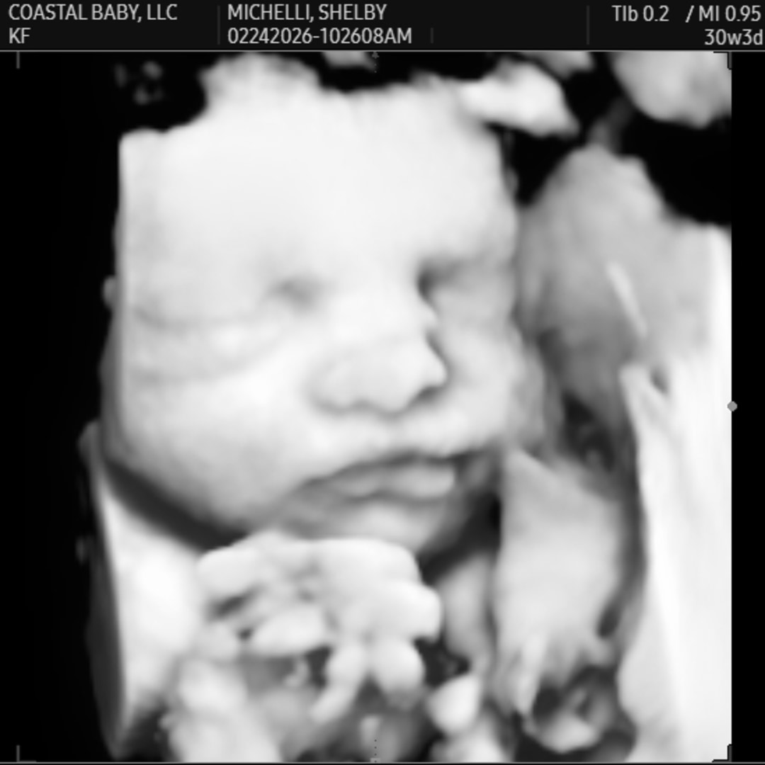 Photo shared by Shelby for their Babylist baby registry.