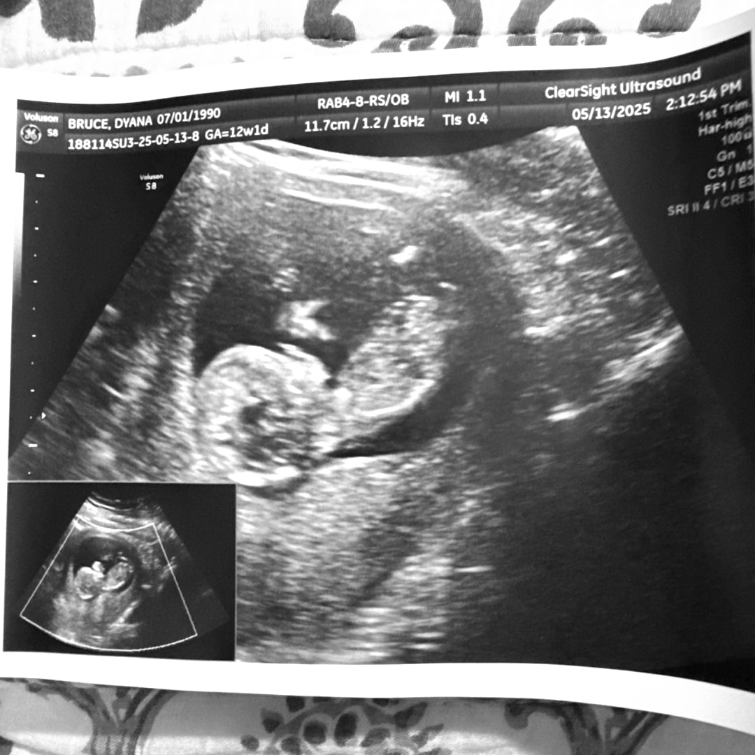 Photo shared by Dyana for their Babylist baby registry.