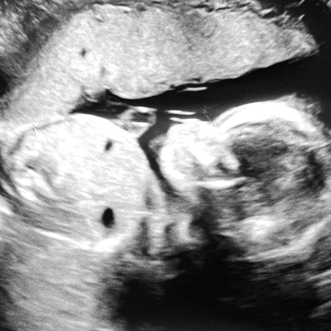 Photo shared by Michelle for their Babylist baby registry.