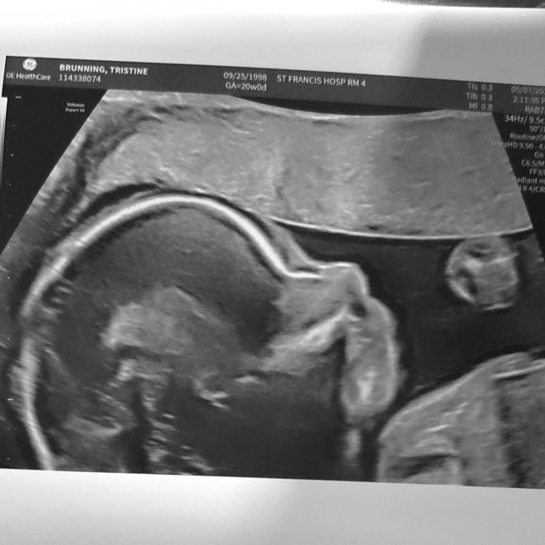 Photo shared by Tristine for their Babylist baby registry.