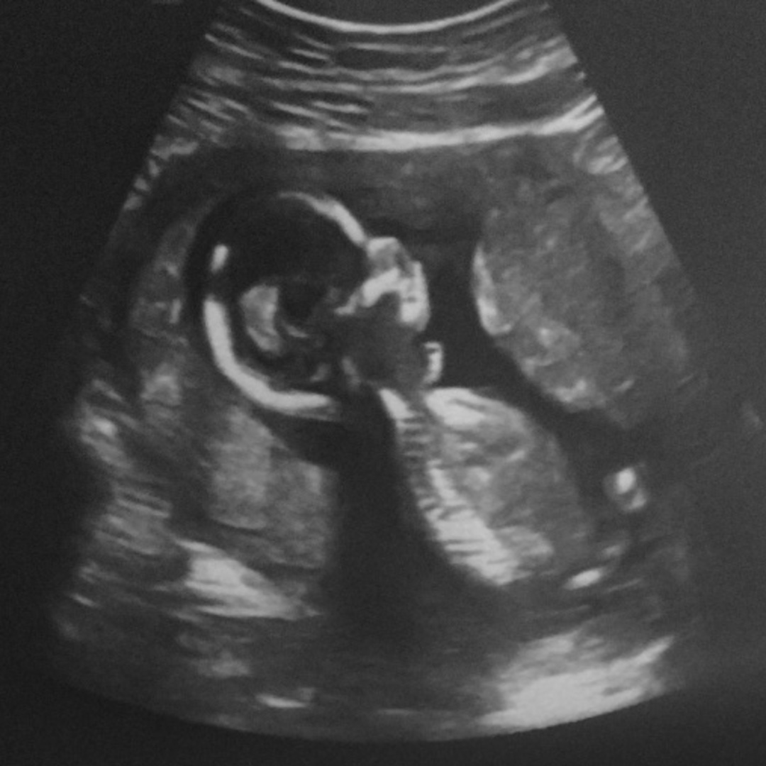 Photo shared by Tanisha for their Babylist baby registry.