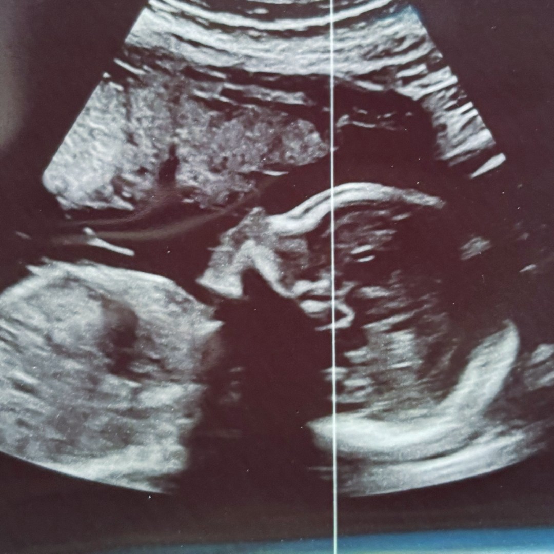 Photo shared by Jazline for their Babylist baby registry.