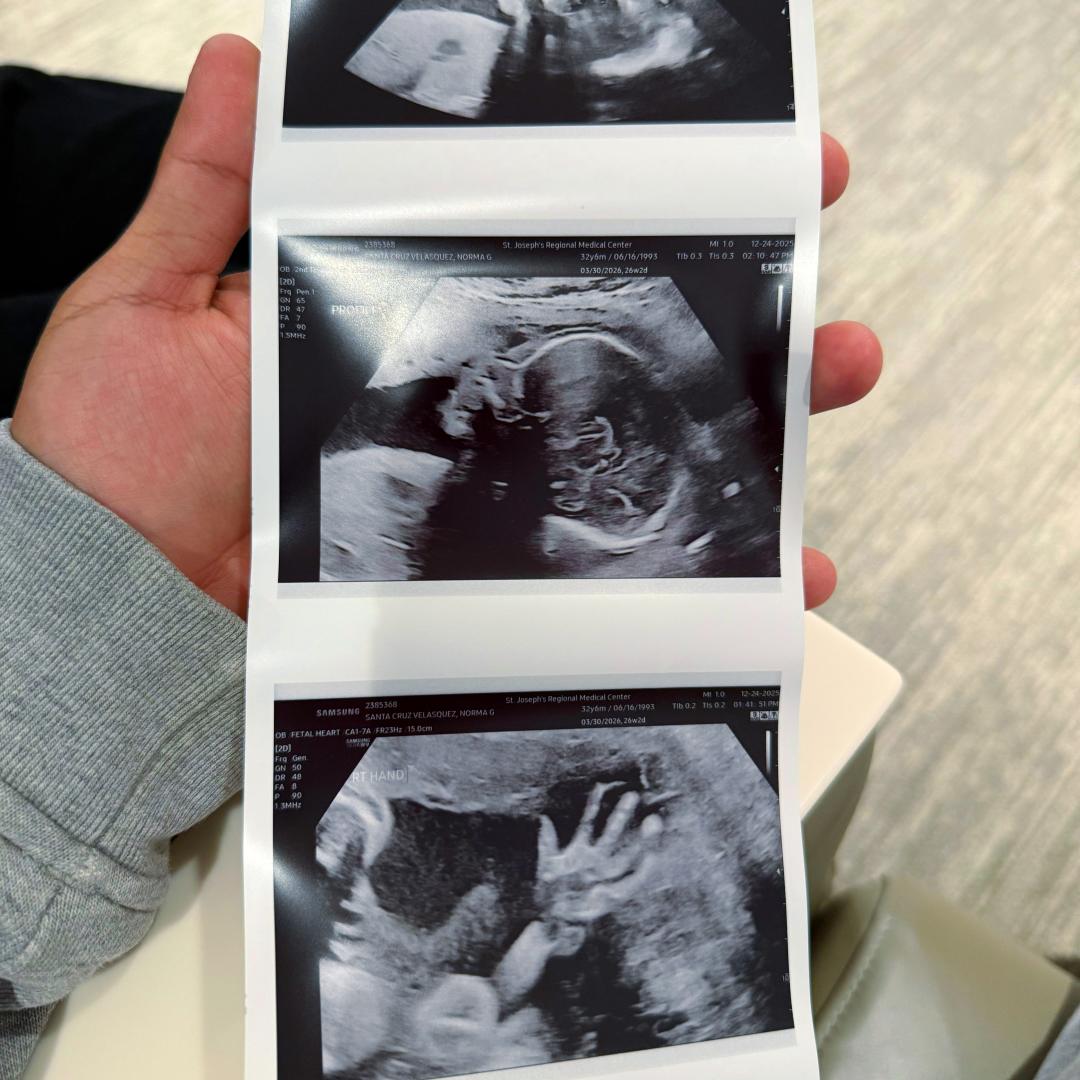 Photo shared by Norma for their Babylist baby registry.